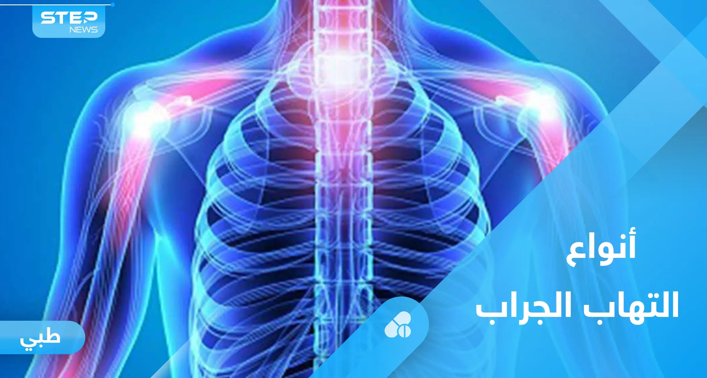 التهاب الجراب وآلام المفاصل.. كل ما عليك معرفته: المفاصل