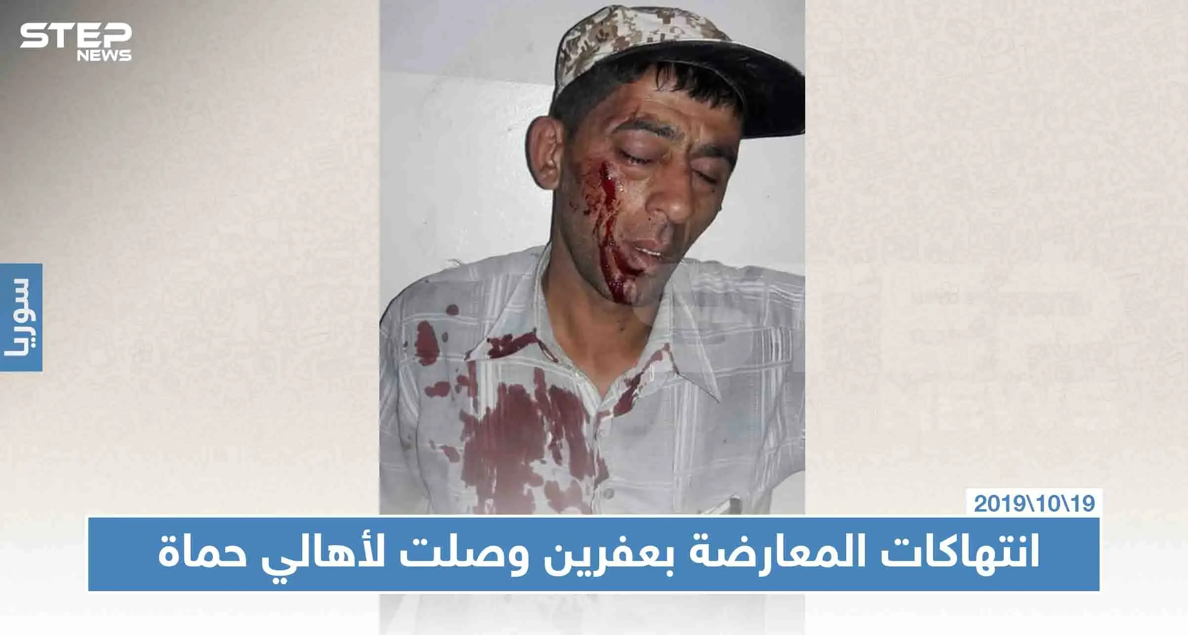 عناصر فيلق الشام يعتدون على نازح من حماة بالضرب المبرح، لهذا السبب: انتهاكات