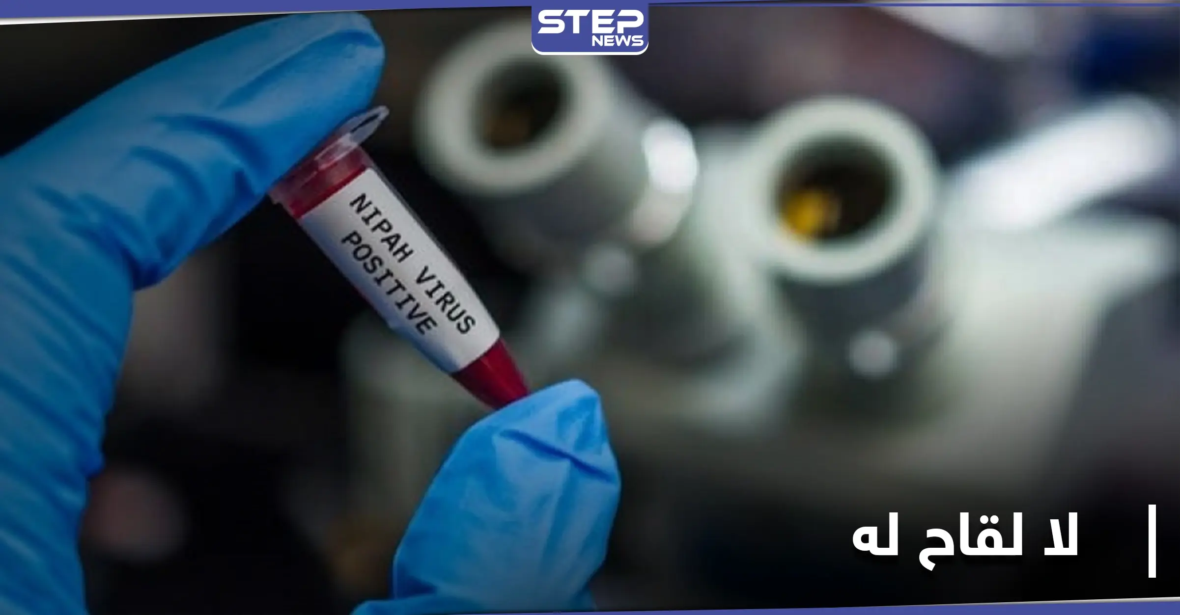 8 أعراض مشتركة بين فيروس "نيباه" الخطير و"كورونا".. تعرّف عليها: فيروس نيباه