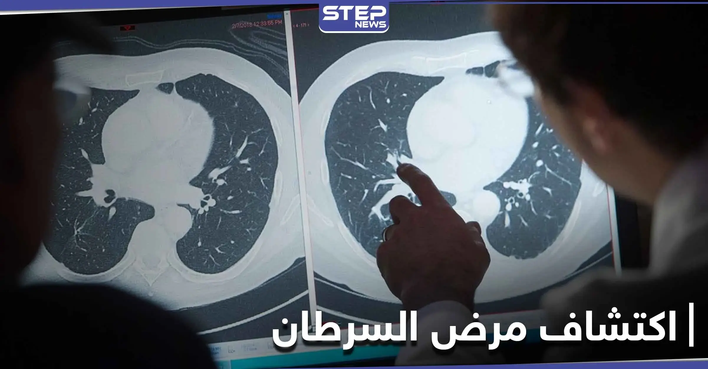 علامة تنذر بوجود أورام سرطانية في الجسم قبل ظهورها.. وتمكن من اكتشافها مبكراً: الجهاز المناعي