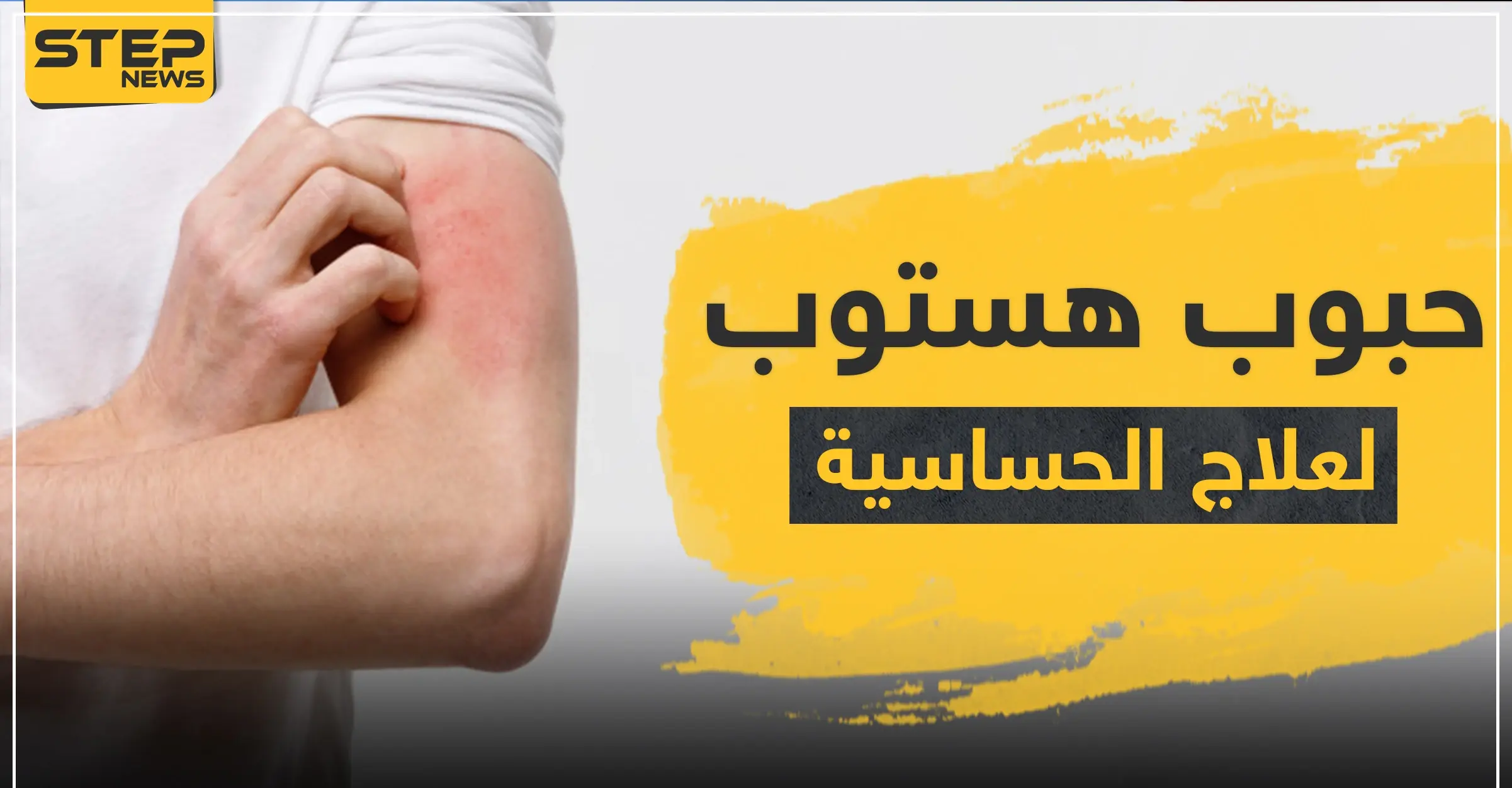 حبوب هستوب لعلاج الحساسية: جفاف