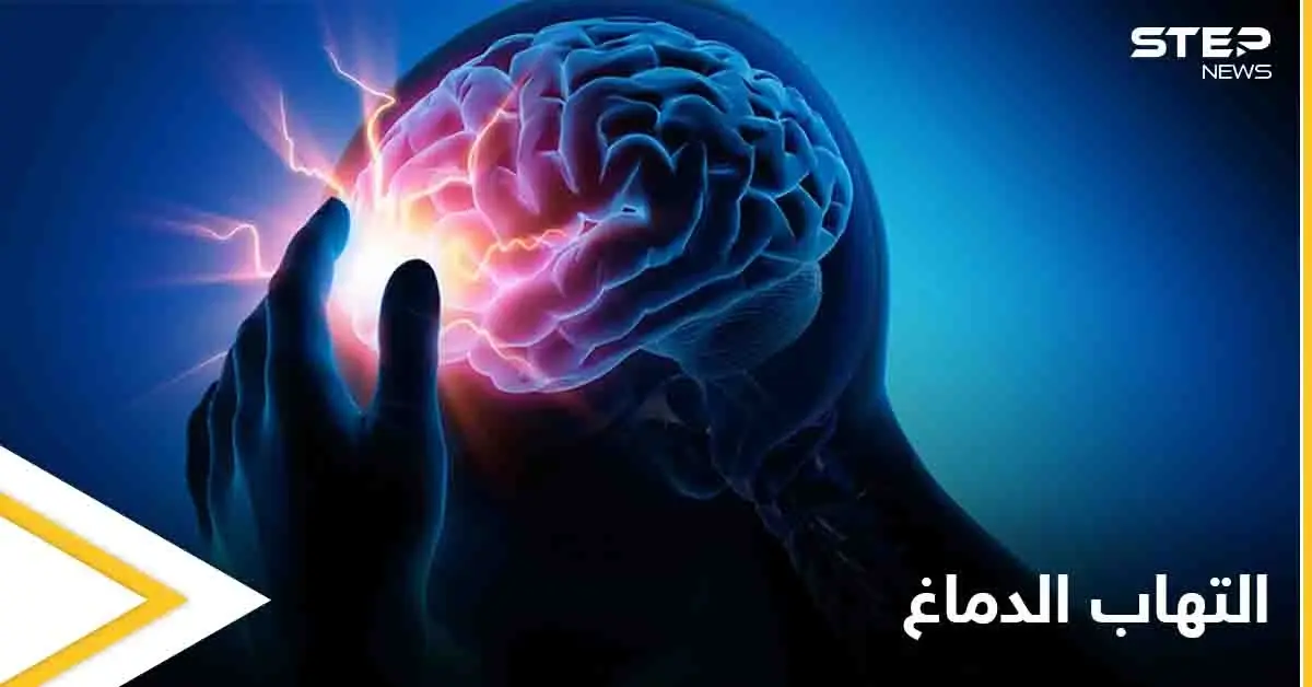 تعرف على مرض التهاب الدماغ ومخاطره الصحية وكيفية الوقاية منه: علاج