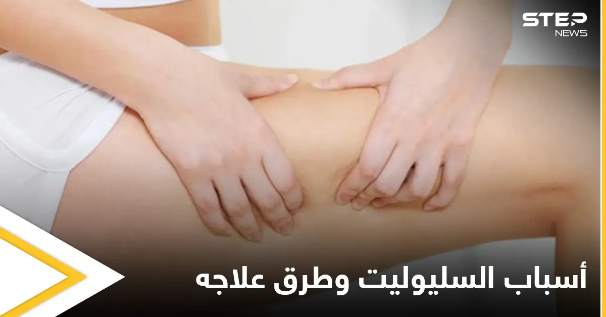 ماهو السليوليت ومأ أسبابه وإصابته للنساء بشكل أكبر إليك أهم المعلومات: علاج
