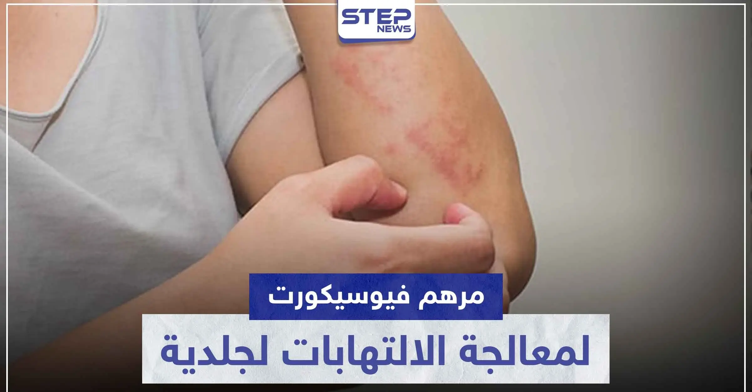 مرهم فيوسيكورت FUCICORT لمعالجة الالتهابات لجلدية: الأسماء التجارية