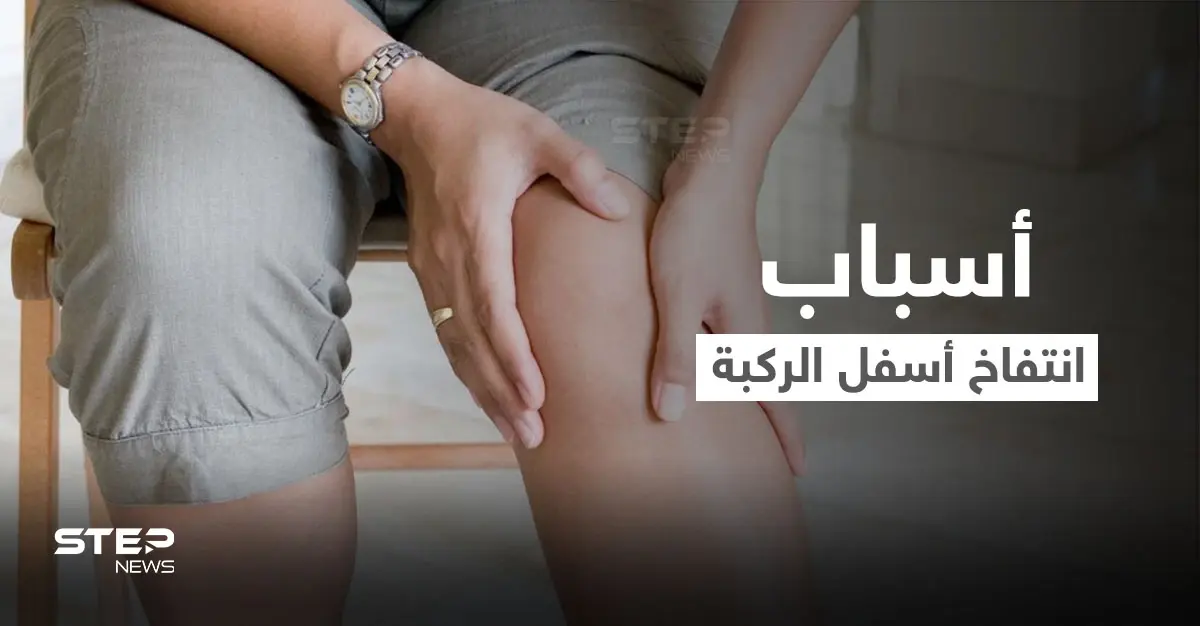 تعرف على أسباب انتفاخ أسفل الركبة وطرق العلاج: انتفاخ أسفل الركبة