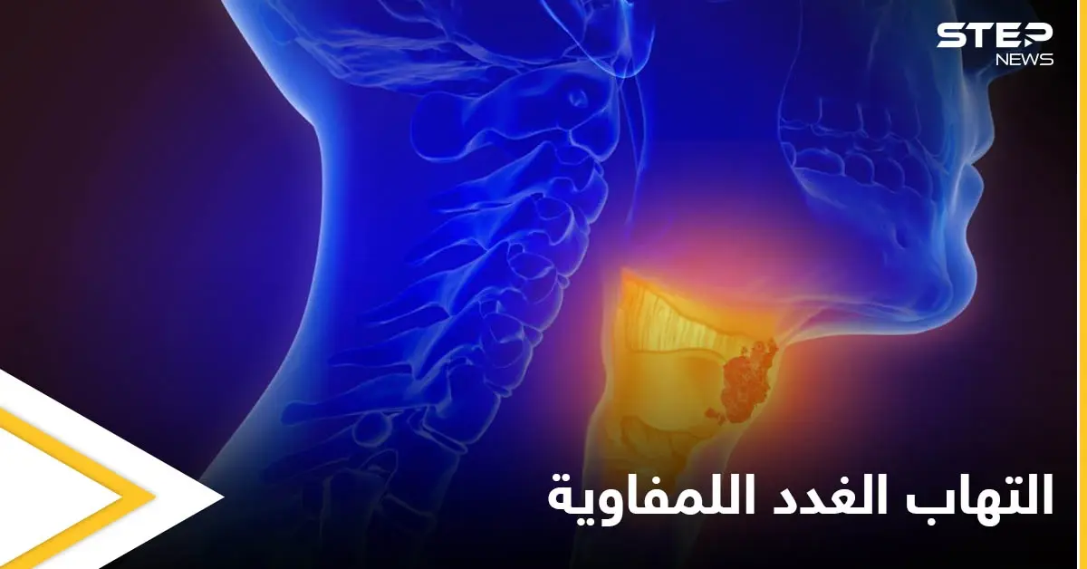 أسباب التهاب الغدد اللمفاوية و أهم طرق علاجها في المنزل: العقد اللمفاوية