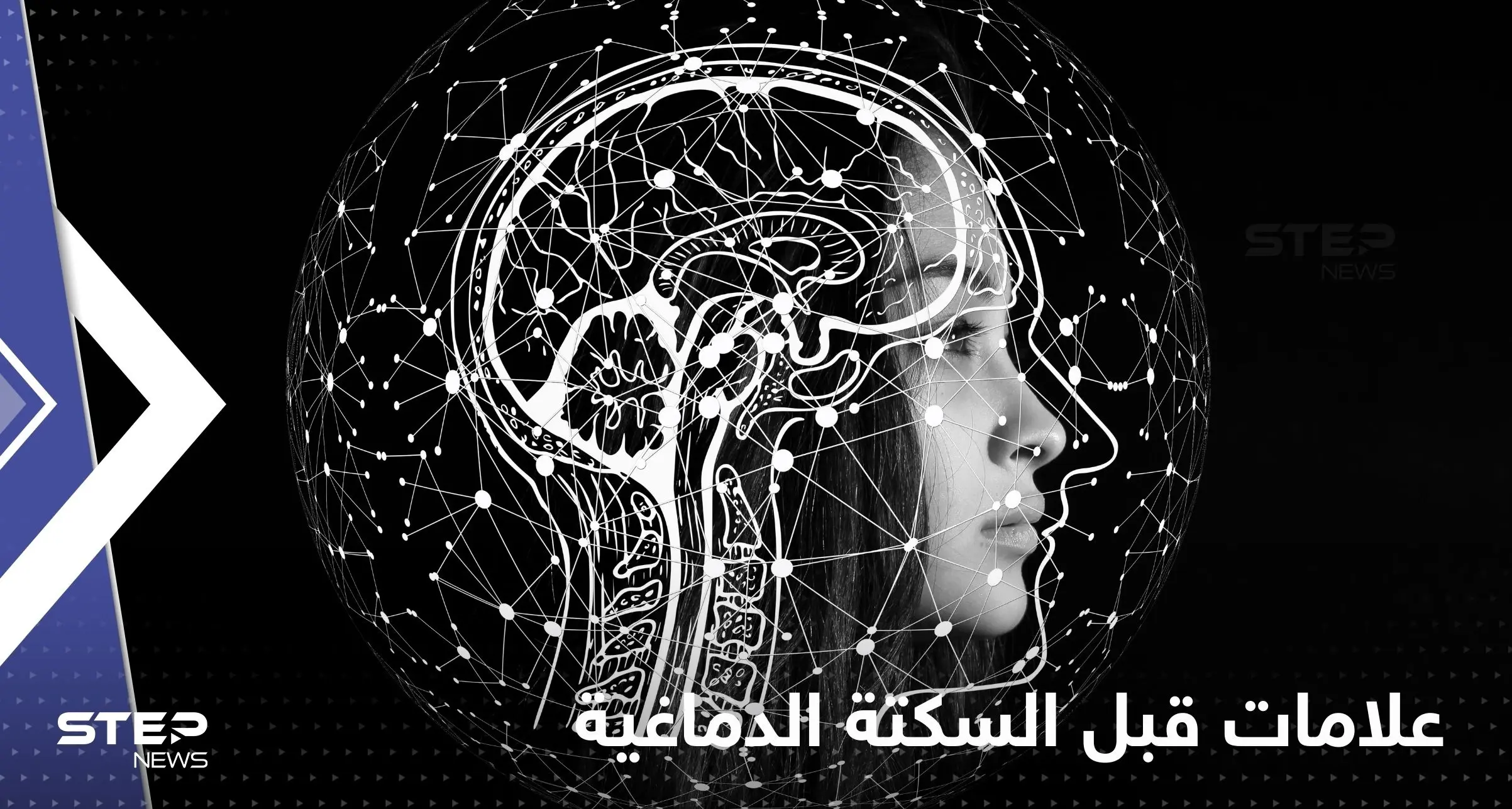 تظهر قبل "أيام" من سكتة كبيرة.. علامات تطرأ لدى حصول "سكتة دماغية صغيرة": السكتة الدماغية