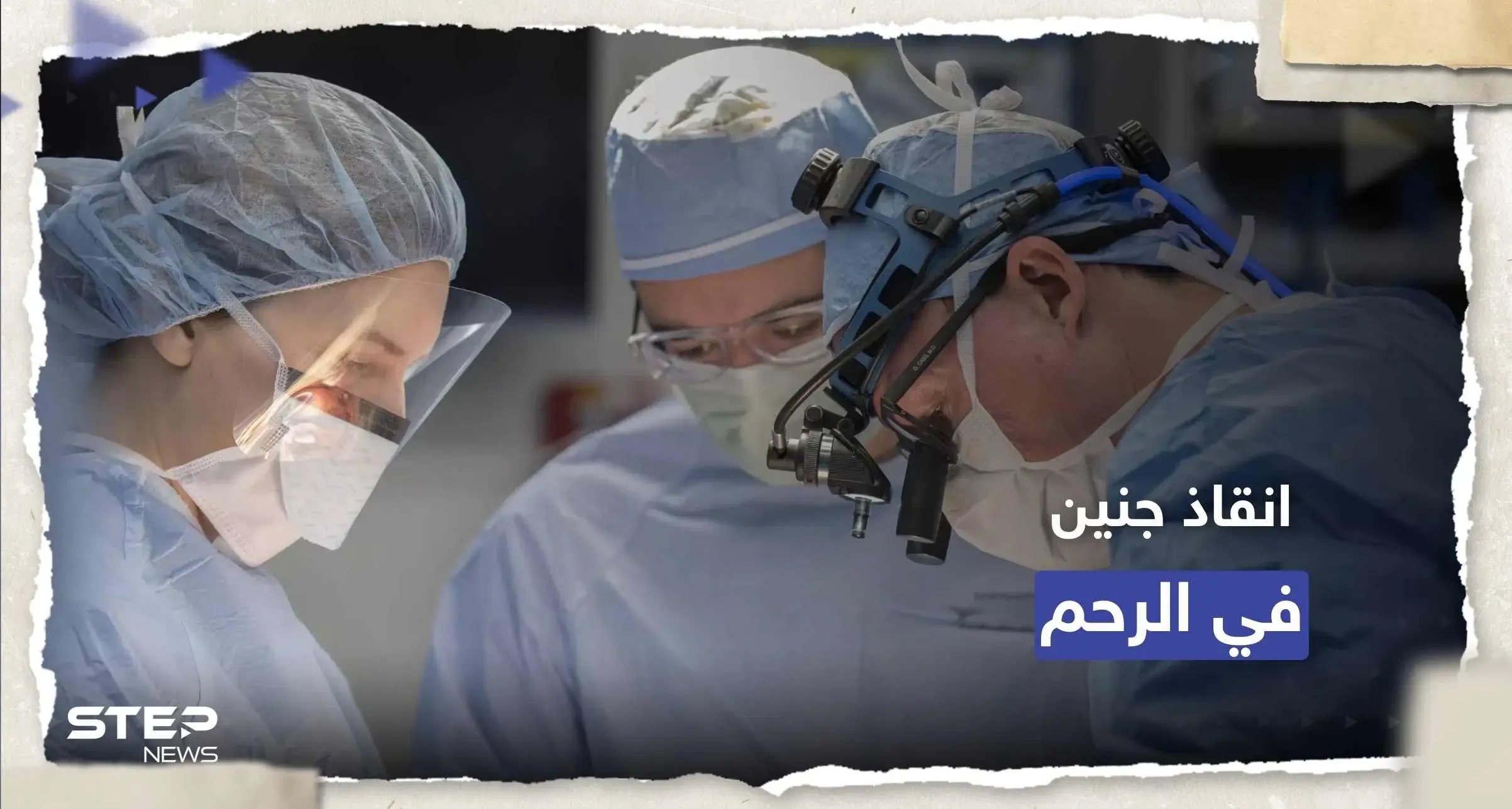 الأولى من نوعها.. جراحة ناجحة لدماغ جنين برحم أمه: ولادة