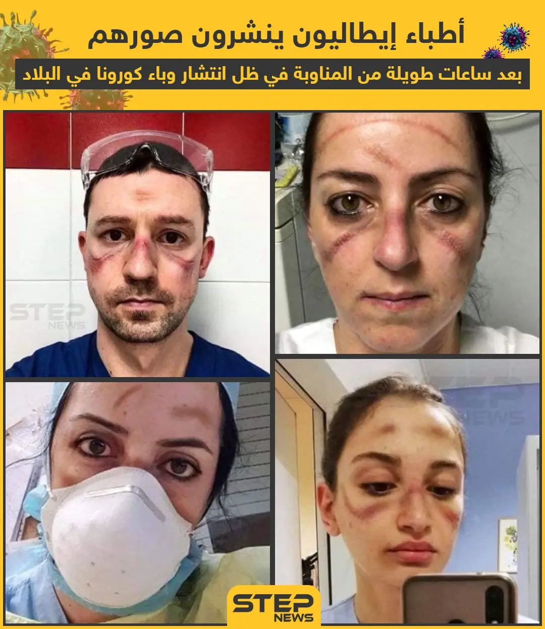 أطباء إيطاليون بعد ساعات طويلة من علاج مصابي كورونا: علاج كورونا