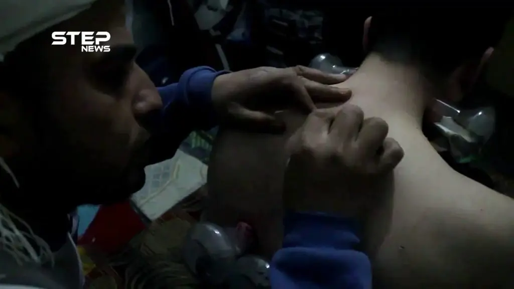 تعرف على الحجامة في مدينة الباب بريف حلب: الباب