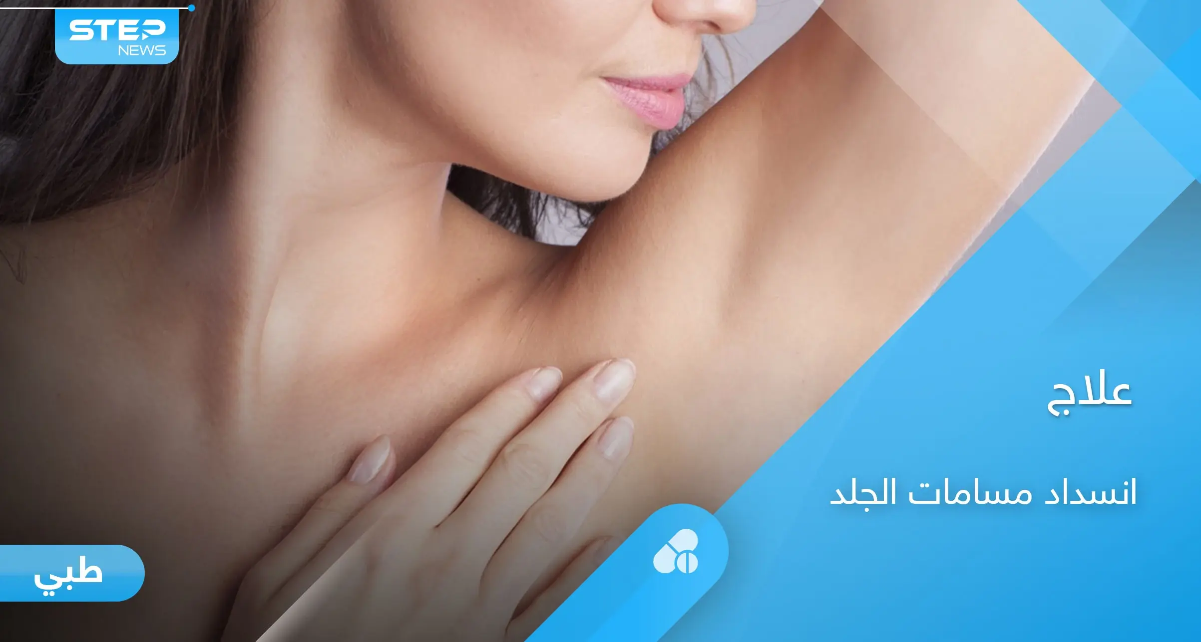 علاج انسداد مسامات العرق ومضاعفاتها المزعجة بطرق بسيطة: ارتفاع درجة الحرارة