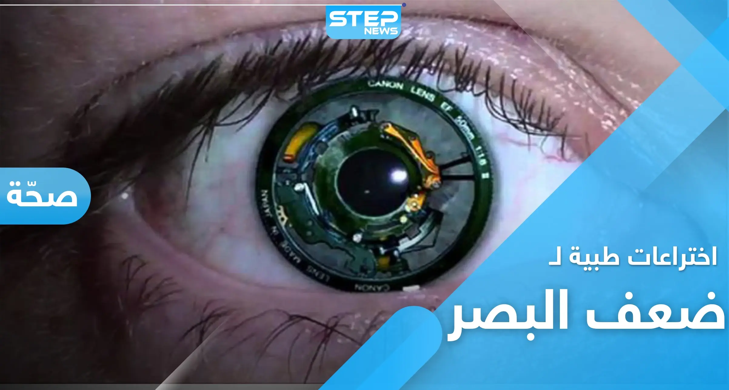 اختراعات تخلصك من ضعف النظر.. تعرّف على العين الصناعية والشبكية الحية: ضعف البصر اعراضه