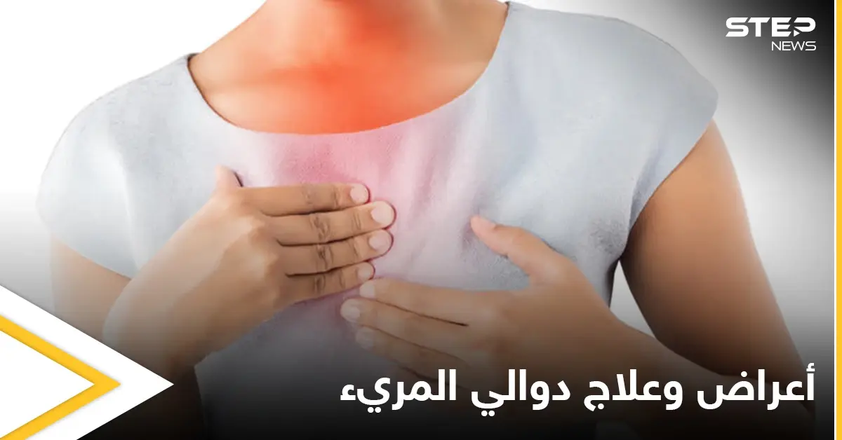 ما هي دوالي المريء وأعراضها وطرق علاجها إليك أهم المعلومات: علاج