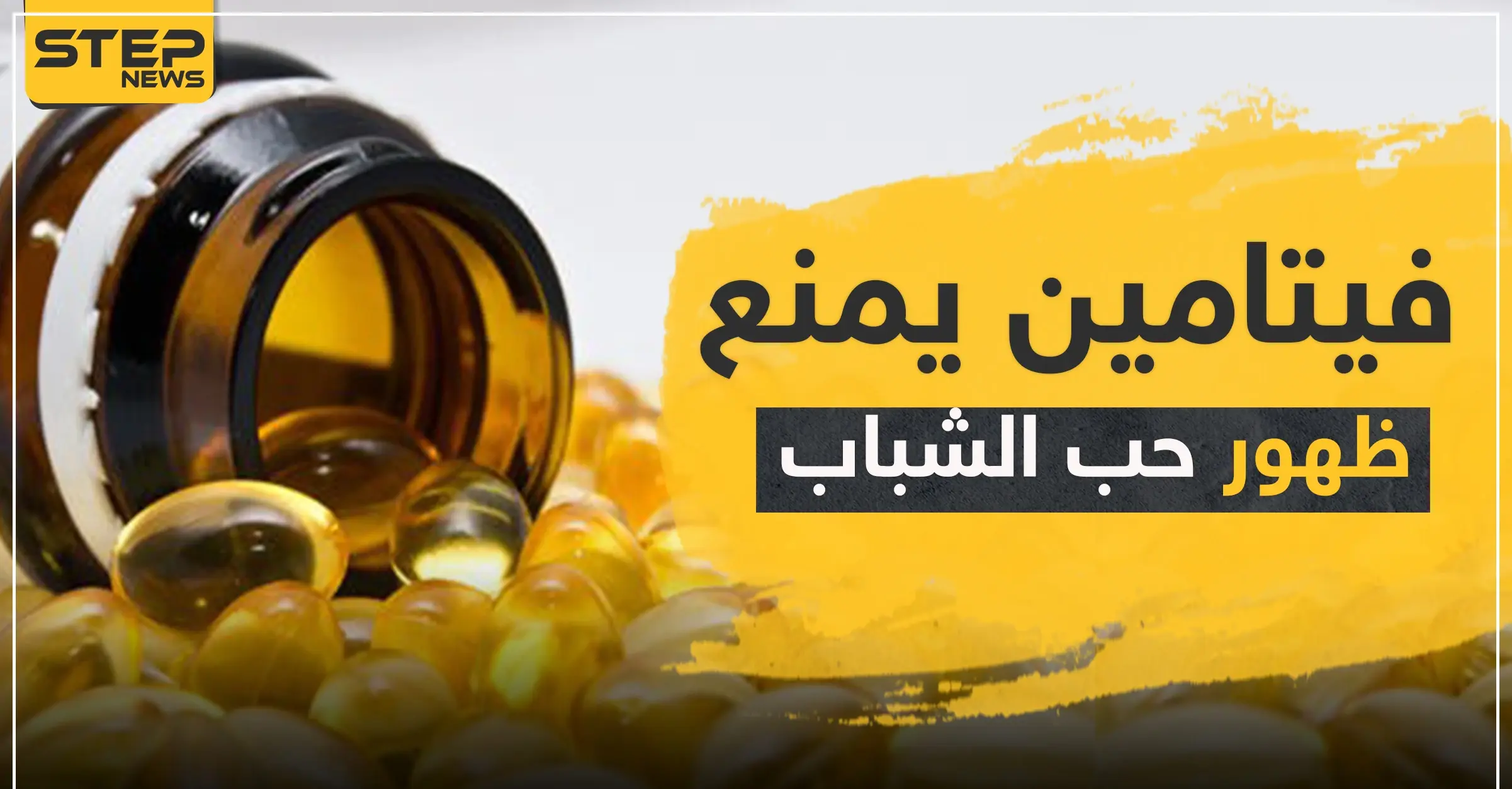 إذا كنت تعاني منها.. فيتامين يمنع ظهور حب الشباب: فيتامين "C"