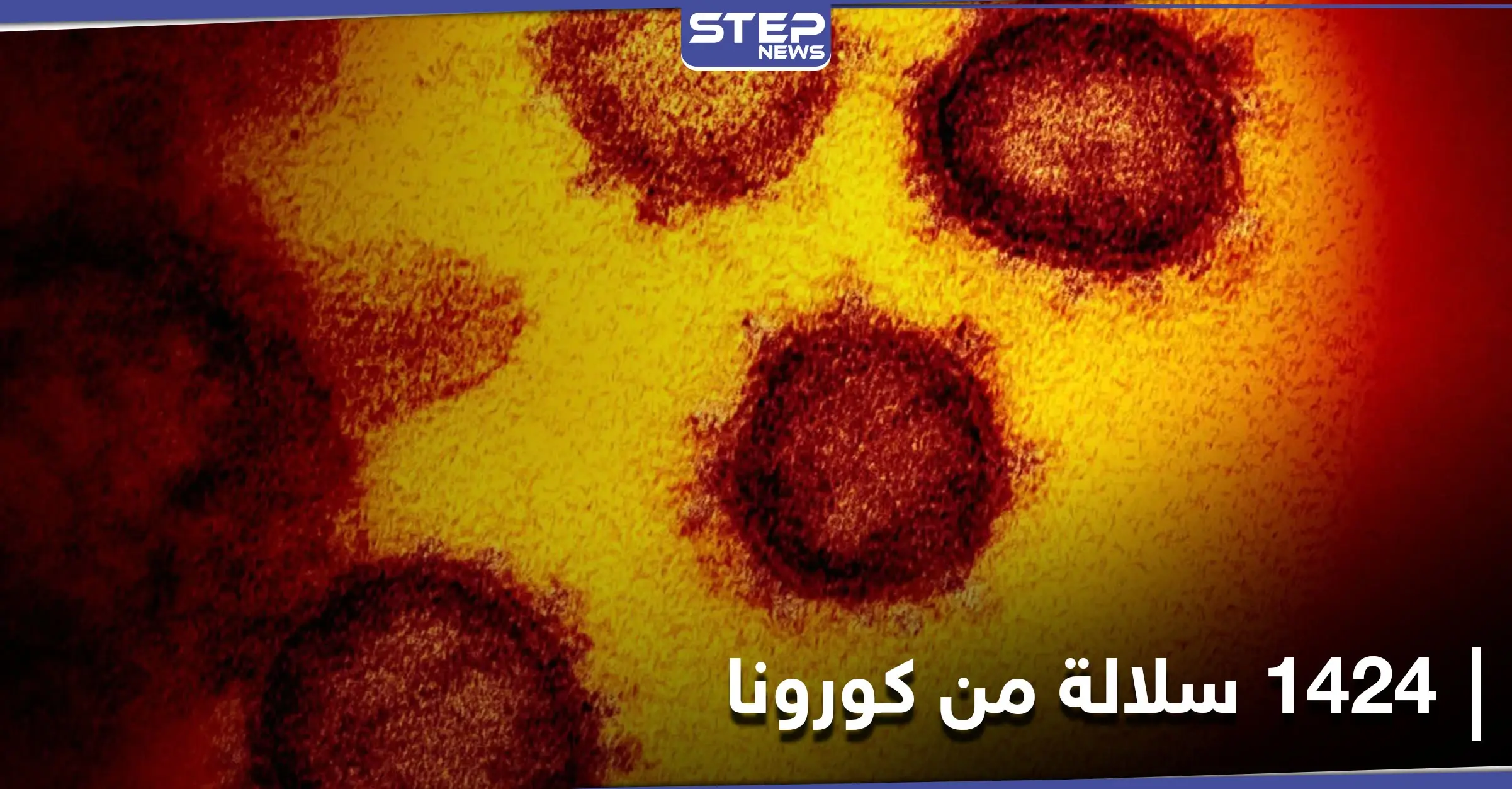 روسيا تكشف عن رصد 1424 سلالة من فيروس كورونا في البلاد: فيروس كورونا المستجد