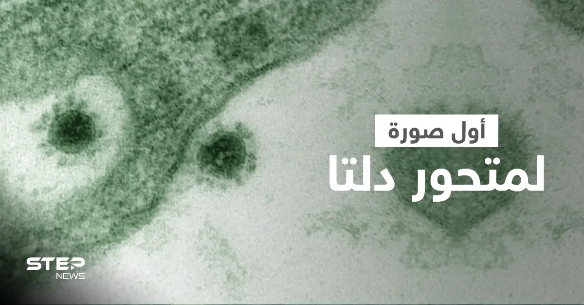 شاهد مجهر إلكتروني يلتقط أول صورة لـ متحور دلتا ينمو كخلايا القرد الأفريقي (صورة): متحور دلتا