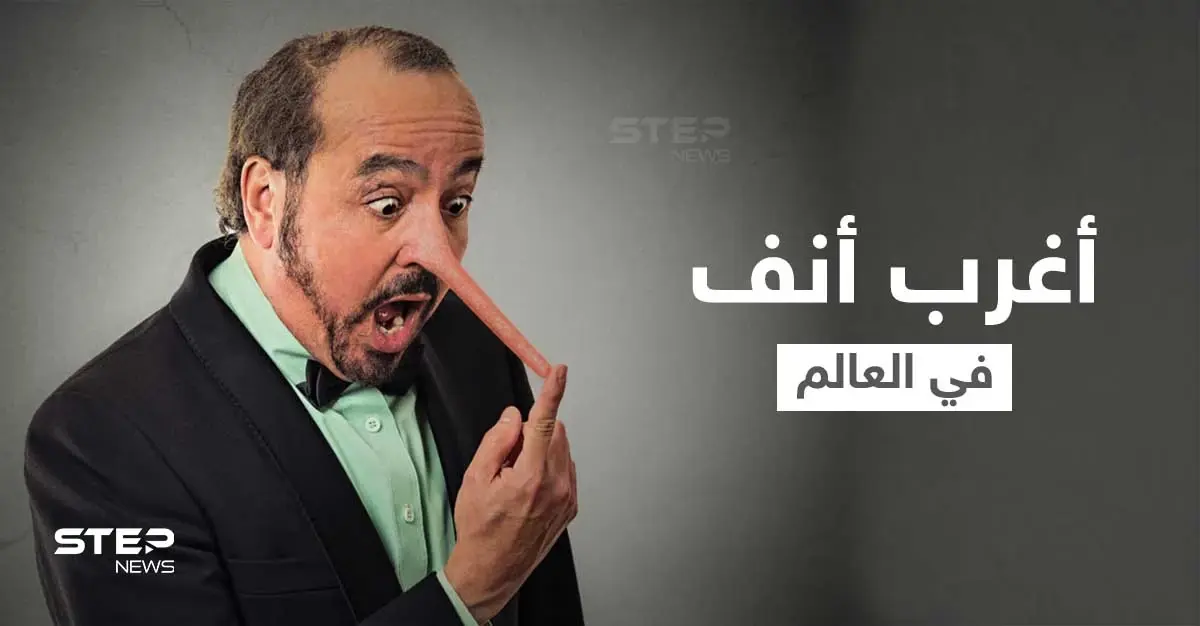 شاهد|| "أرسل الله ملاكاً للاعتناء بي".. صاحب أغرب أنف في العالم يكشف كيف عاد شكل وجهه لطبيعته: كونرادو إسترادا