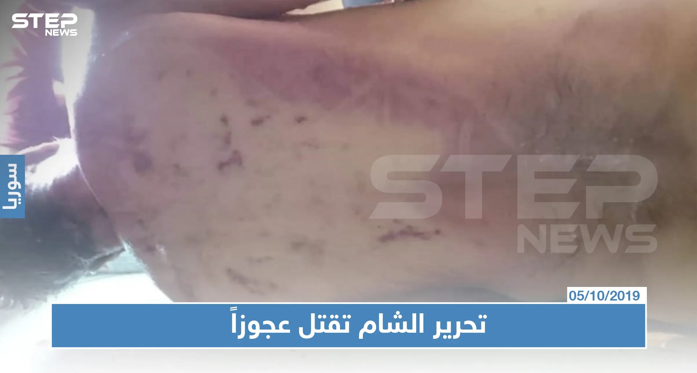 بالصور: مقتل رجل تحت التعذيب بسجون هيئة تحرير الشام: الموت تحت التعذيب