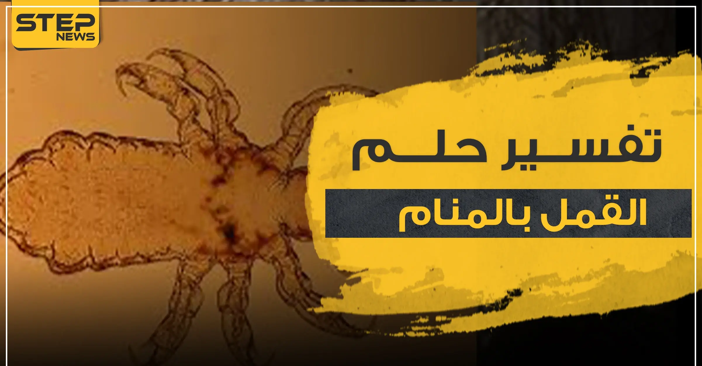 تفسير حلم القمل عند ابن سيرين وعدد من المفسرين: تفسير حلم القمل