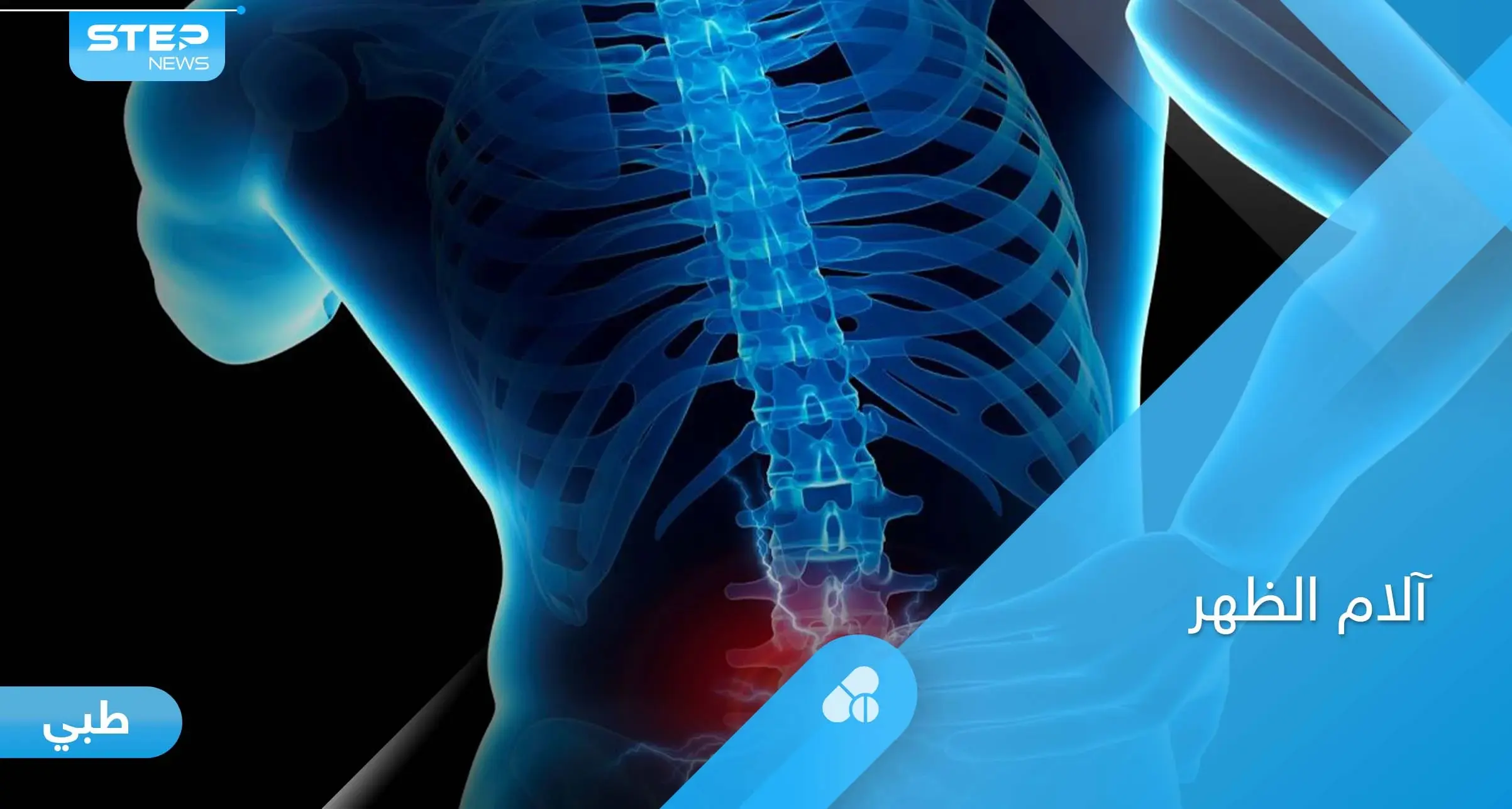 أسباب آلام أسفل الظهر وتأثيرها على الساقين وطرق الوقاية منها: التهاب المفاصل