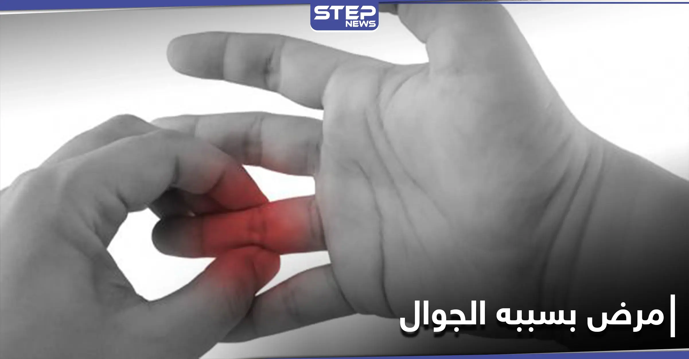 فرط استخدام الهاتف المحمول قد يسبب التهاب مفاصل الأصابع.. إليك طريقة تفاديه: مرض جديد