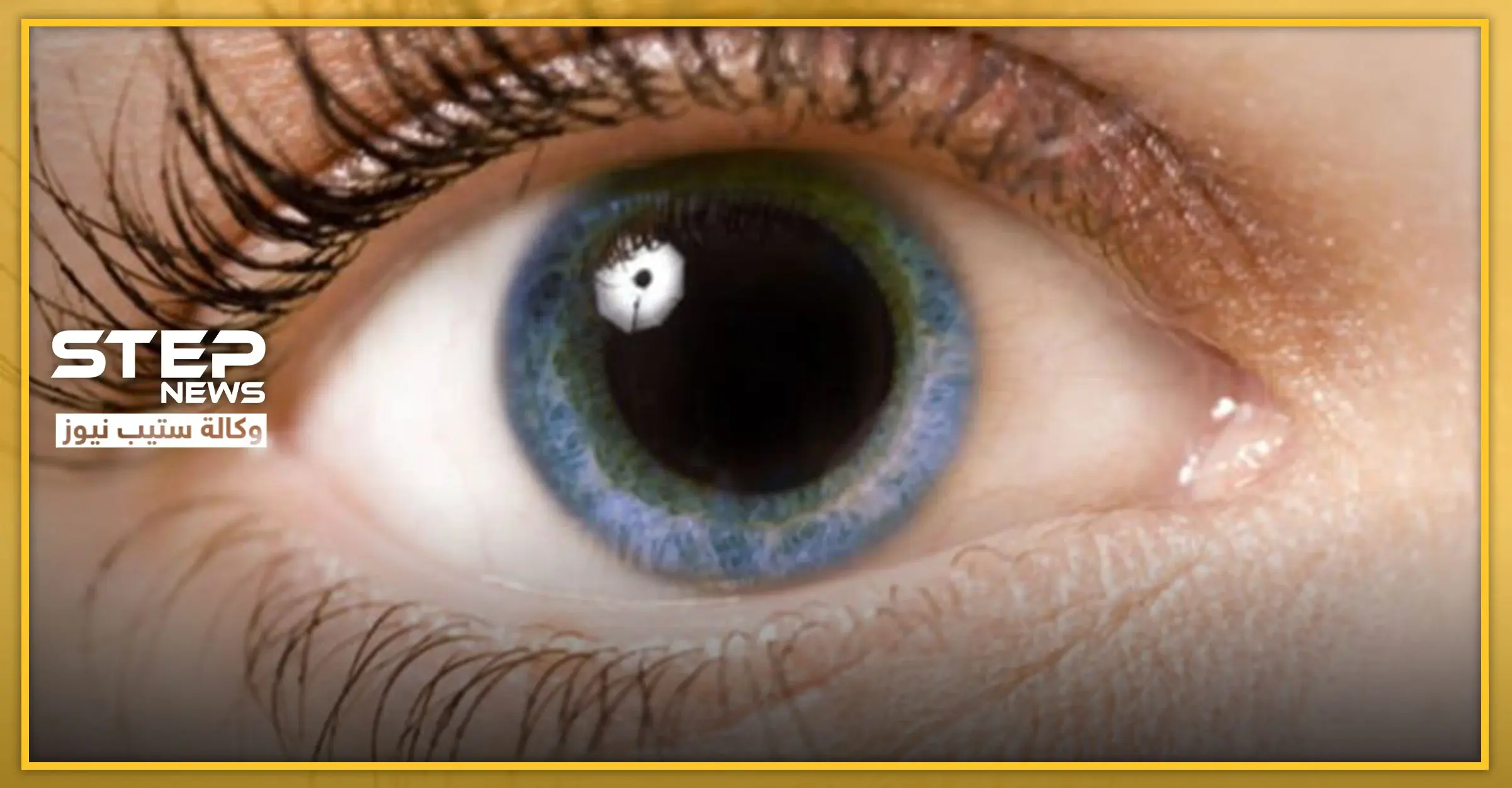 انذار صحي.. علامة صغيرة في العين تدل على نوبة قلبية قريبة: جلطات الدم