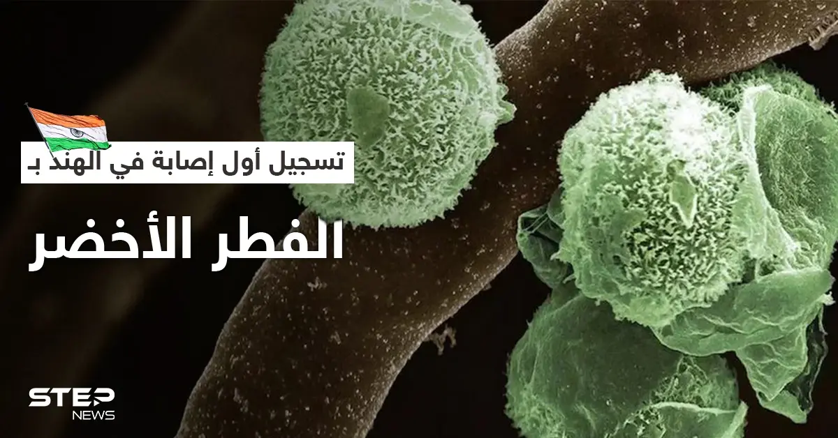 الهند تسجل أول إصابة بالفطر الأخضر في العالم.. وطبيب يشرح أعراضه: وباء