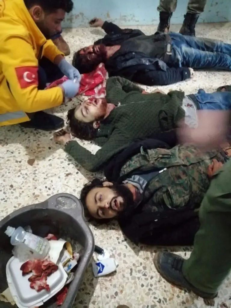 قتلى لـ الجيش الوطني في كلجبرين جرّاء هجوم للميليشيات الكردية: قتلى لـ الجيش الوطني