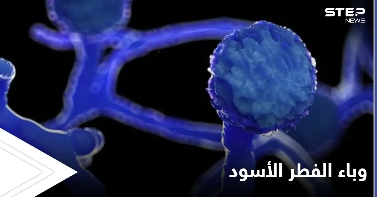 مخاوف من الفطر الأسود.. والصحة العالمية تحذر دولة عربية من وصول المتحور الهندي إليها: سمير غانم