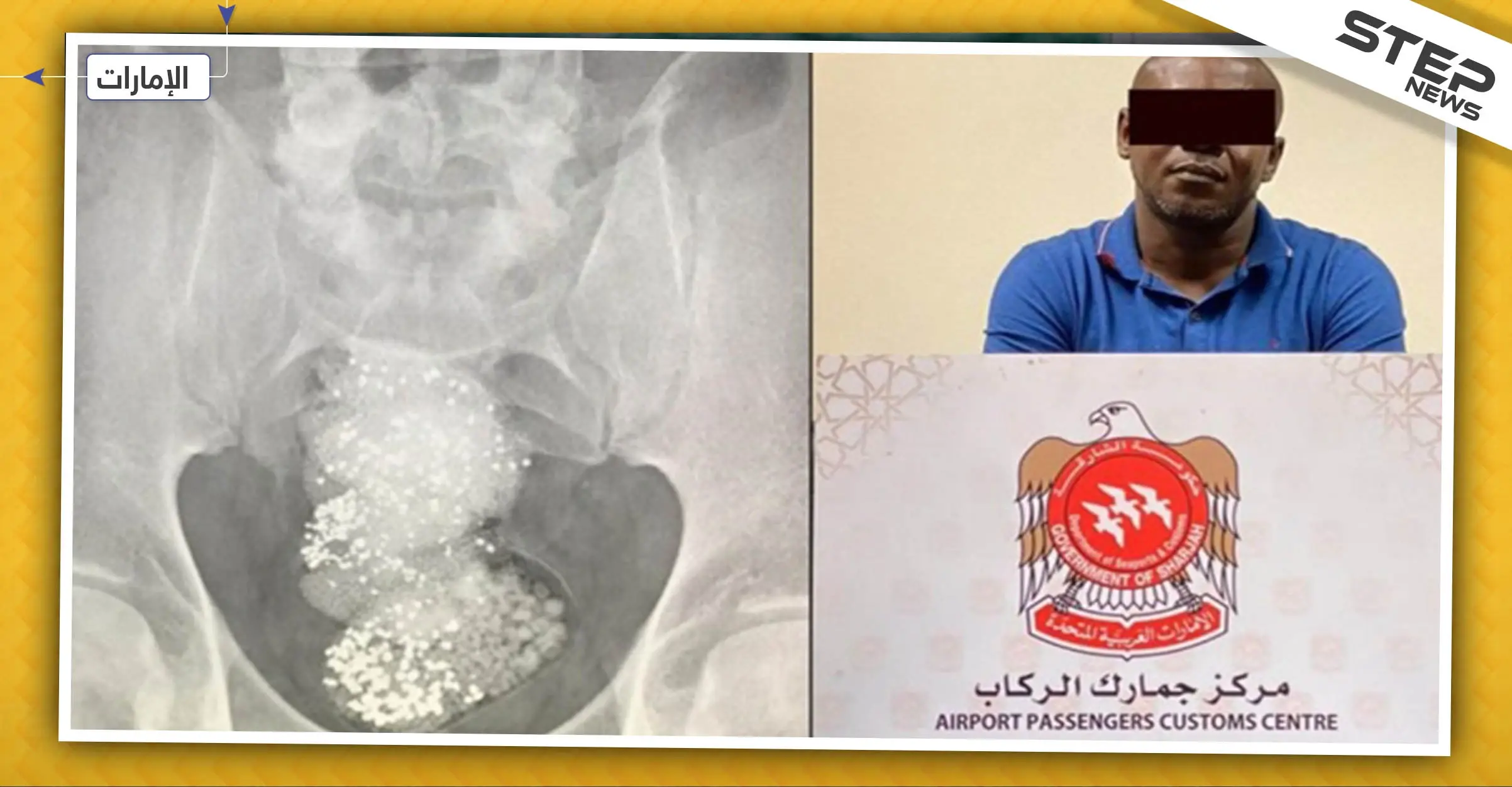 السلطات الإماراتية تلقي القبض على "مهرّب" أخفى الألماس في أحشائه: دولة الإمارات