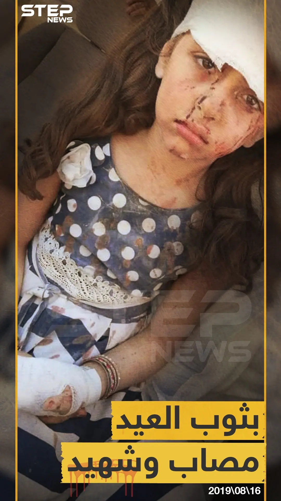 بثوب العيد مصاب وشهيد!!: العيد