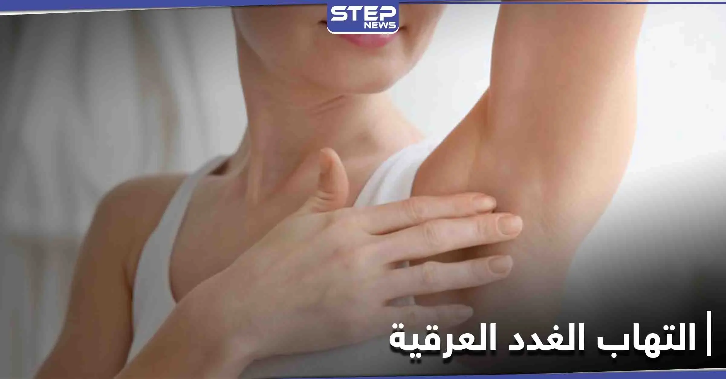 متى يحتاج التهاب الغدد العرقية إلى الجراحة تعرف إلى أعراضه وطرق العلاج: الغدد العرقية