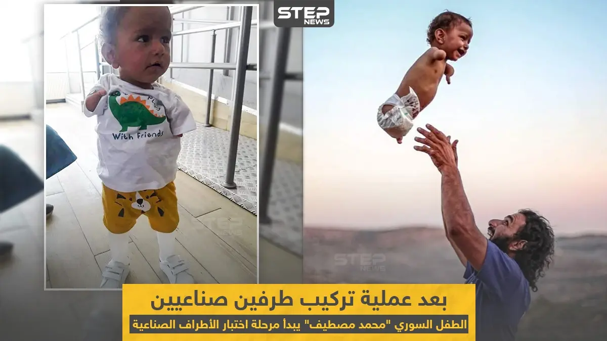 الطفل السوري "محمد مصطيف" بعد عملية تركيب طرفين صناعيين له: مرحلة اختبار