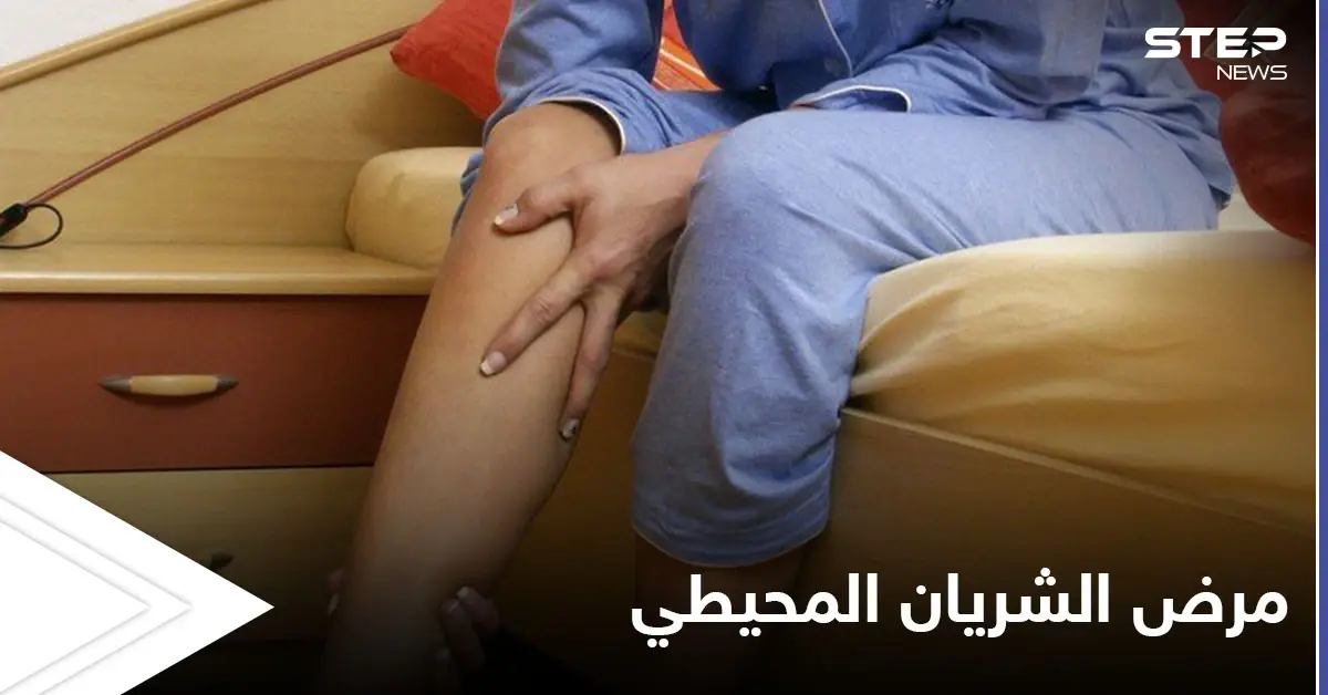 مرض الشريان المحيطي مشكلة صحية تصيب الأطراف وتتسبب بضعفها تعرف عليه: الأوعية الدموية