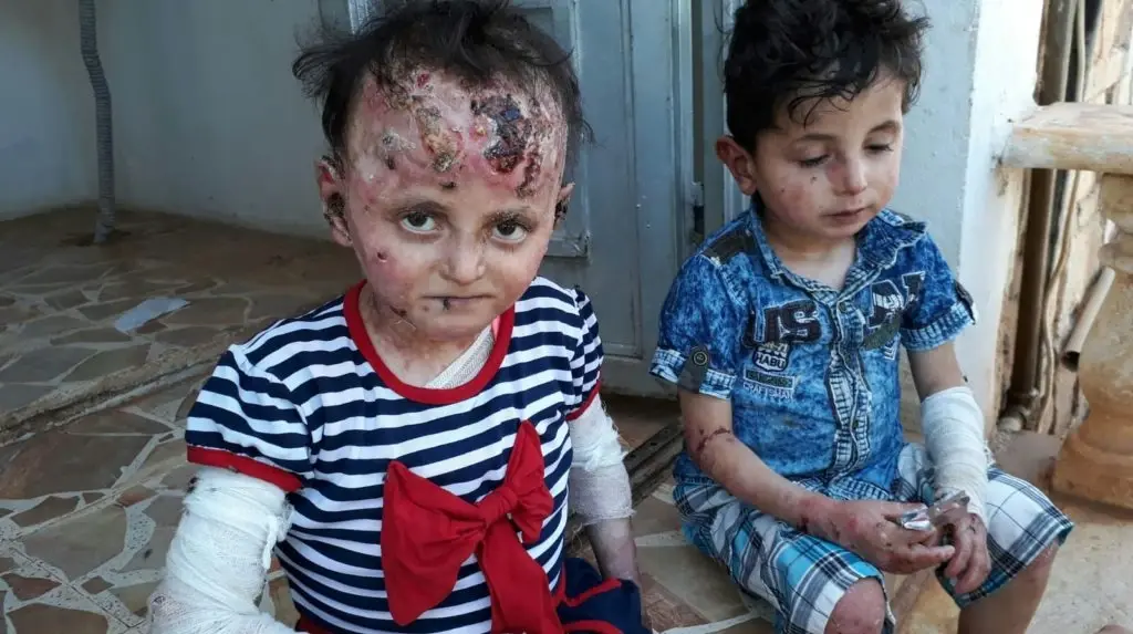 مرض نادر يفتك بطفلين شمالي حلب، ووالدهما يُناشد: ستيب نيوز