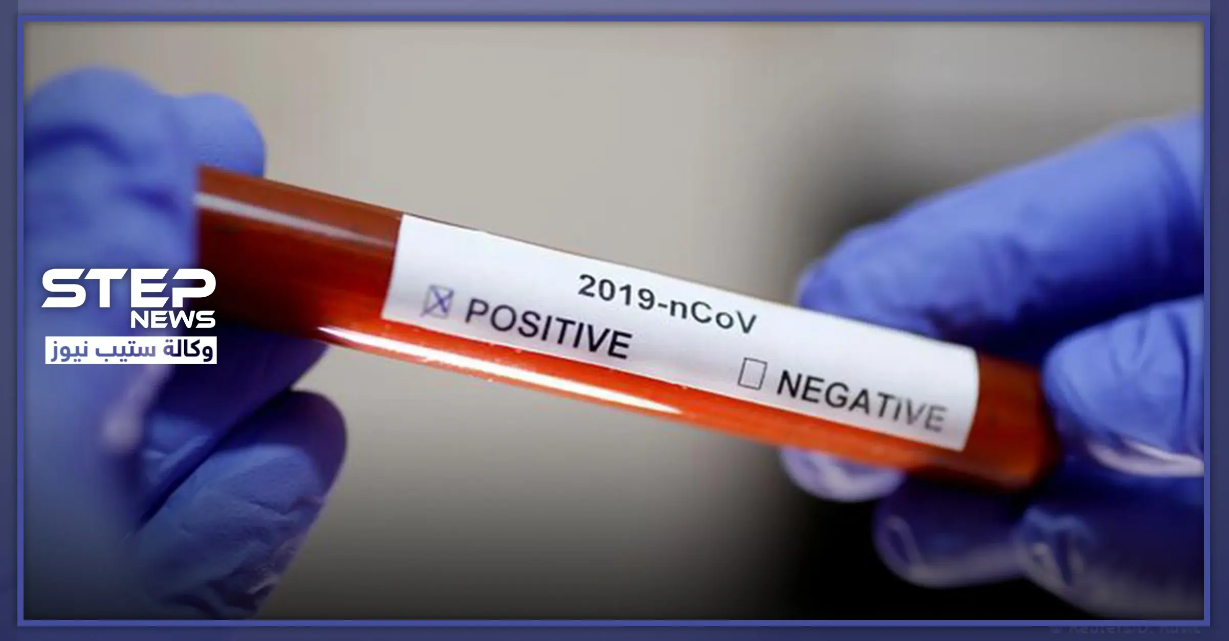 فنانة سورية موالية تعلن إصابتها بالكورونا.. تحيي "الجيش" وتشرح كيف بدأت القصة: فنانة سورية