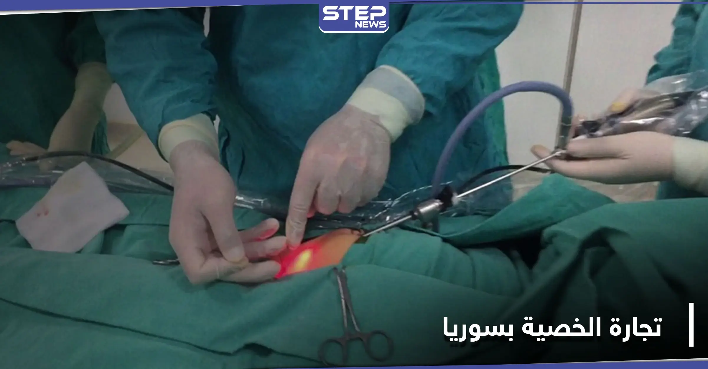  بيع الخصية يشغل بال الشباب السوري..  حقيقة أم إشاعات بعد وصول الأسعار لـ 150 مليون ليرة!: العقم