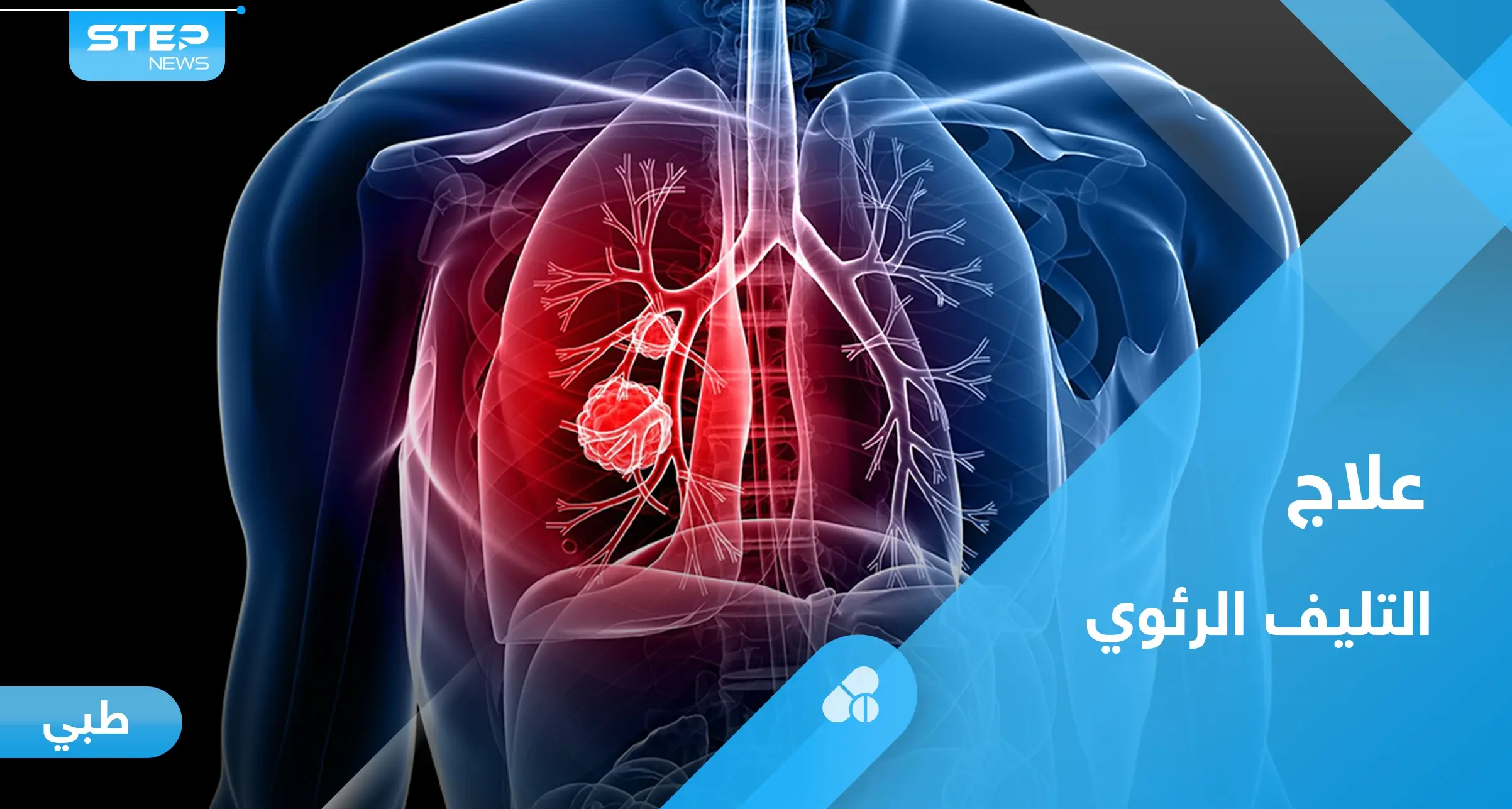 ما هو التليف الرئوي.. تعرف على أعراضه و أبرز طرق العلاج: تليف الرئة