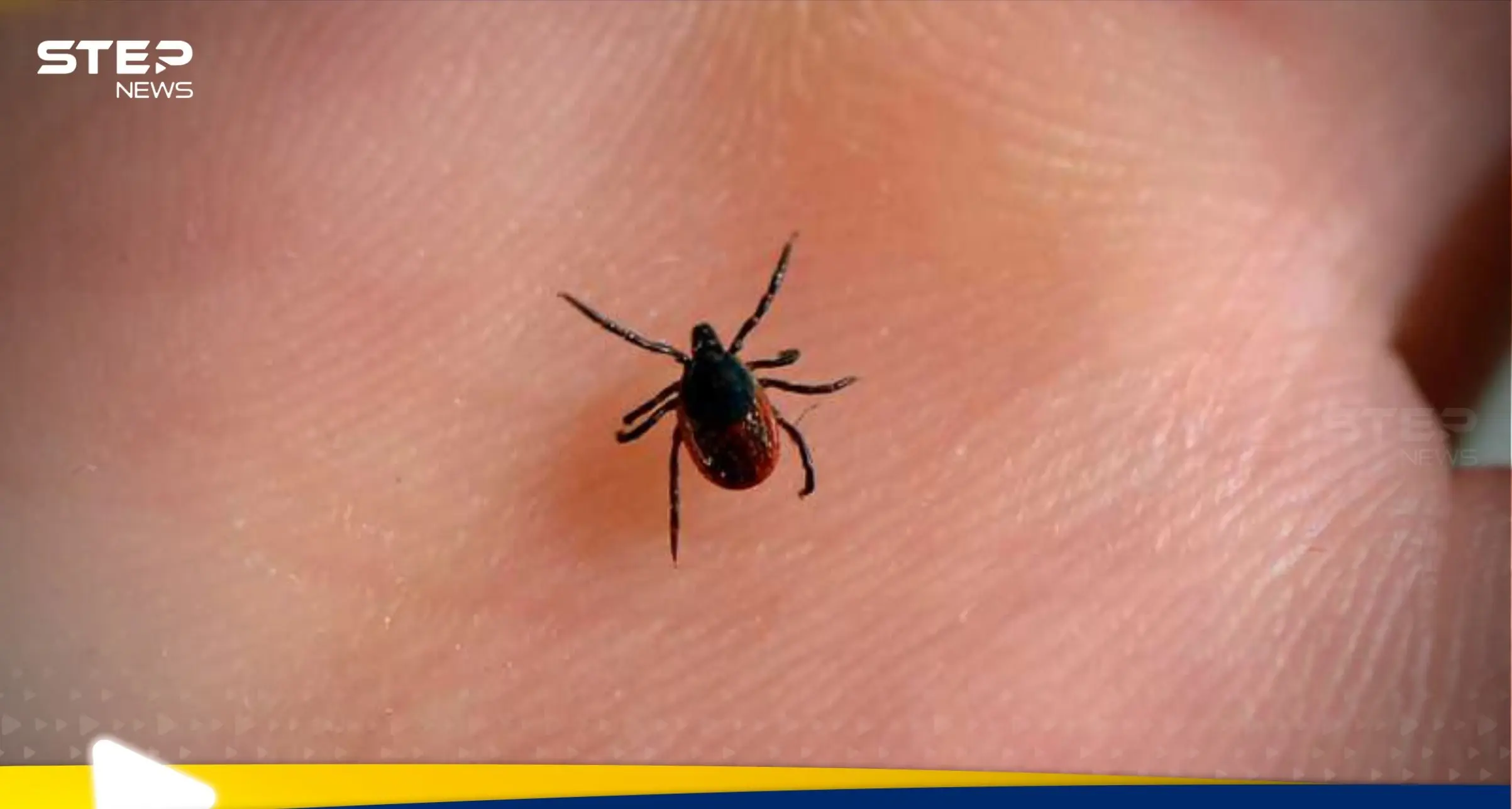 إسطنبول في مرمى "هجوم صامت".. حشرة خطيرة تهدد الصحة العامة: حشرة القراد