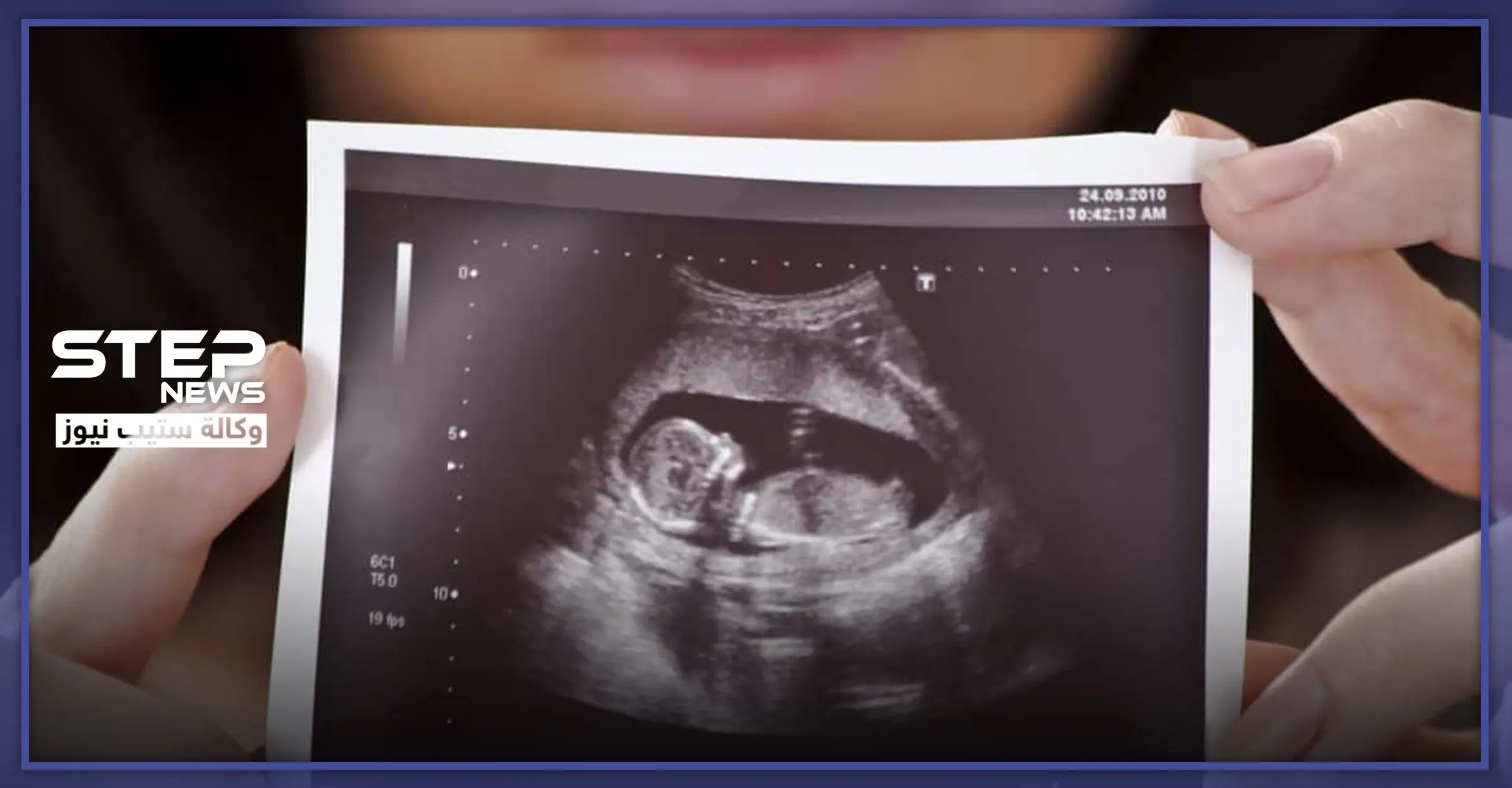 فوائد التصوير رباعي الأبعاد للحامل .. وبعض النصائح الهامة: الحمل والولادة