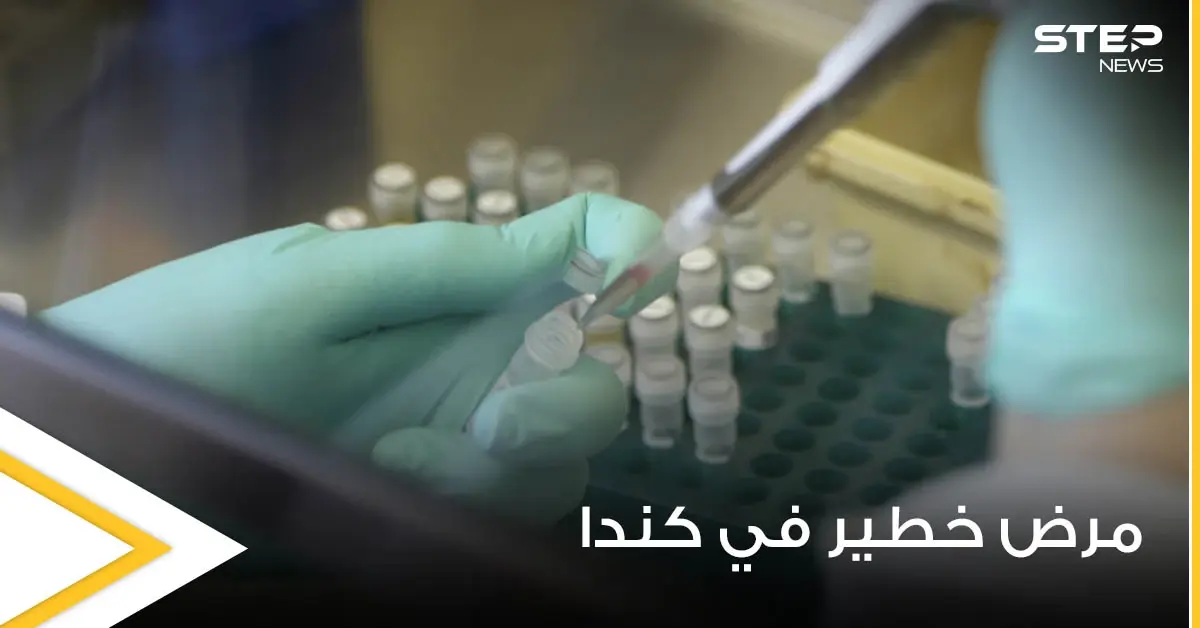 مرض مجهول ينتشر بكندا يحمل أعراضاً غريبة منها رؤية الموتى: مرض مجهول