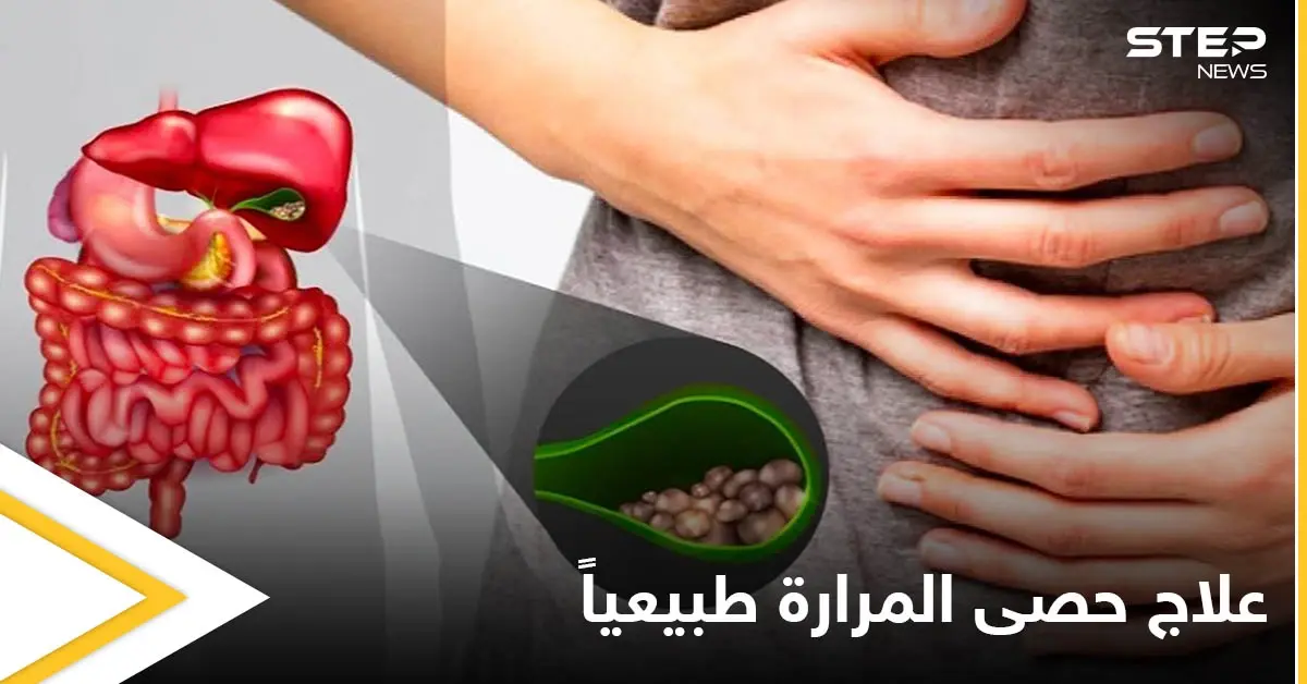 للتخلص من حصى المرارة.. تطهيرها وغسلها بزيت الزيتون إليك الوصفات وأهم المعلومات: علاج