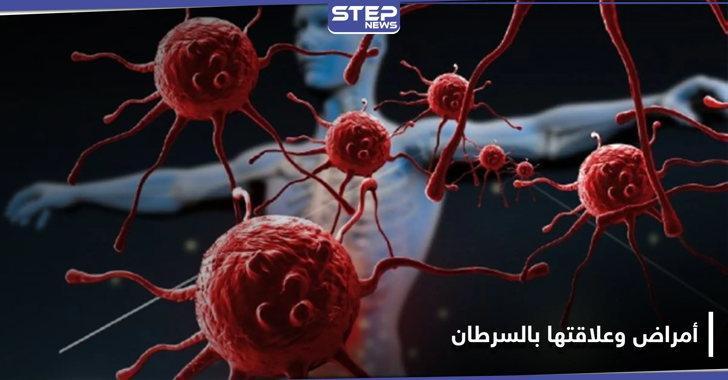 أمراض تسبب تطور السرطان ويمكن أن تسبب في نشأته.. فأحذرها وحاول معالجتها فوراً: تليف الكبد