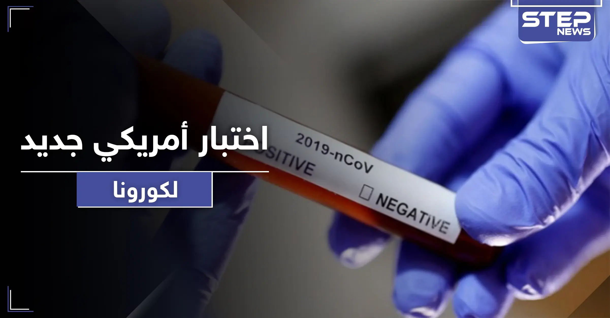 اختبار أمريكي جديد من شأنه كشف ملايين المصابين بكورونا بوقت قياسي: إصابات كورونا