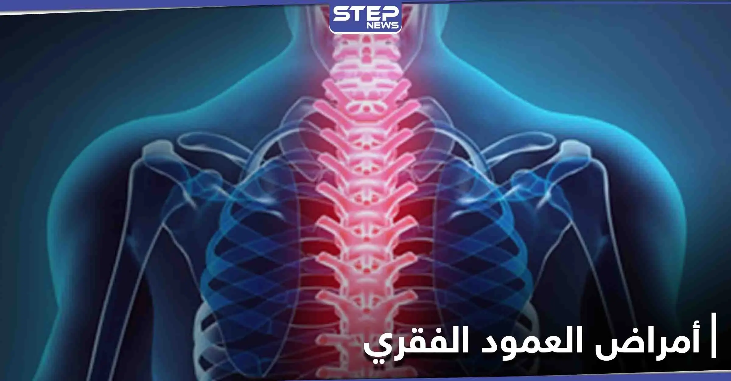 منها السُمنة.. تعرف على أسباب الأمراض التي تصيب العمود الفقري ومدى خطورتها وطرق العلاج: العمود الفقري