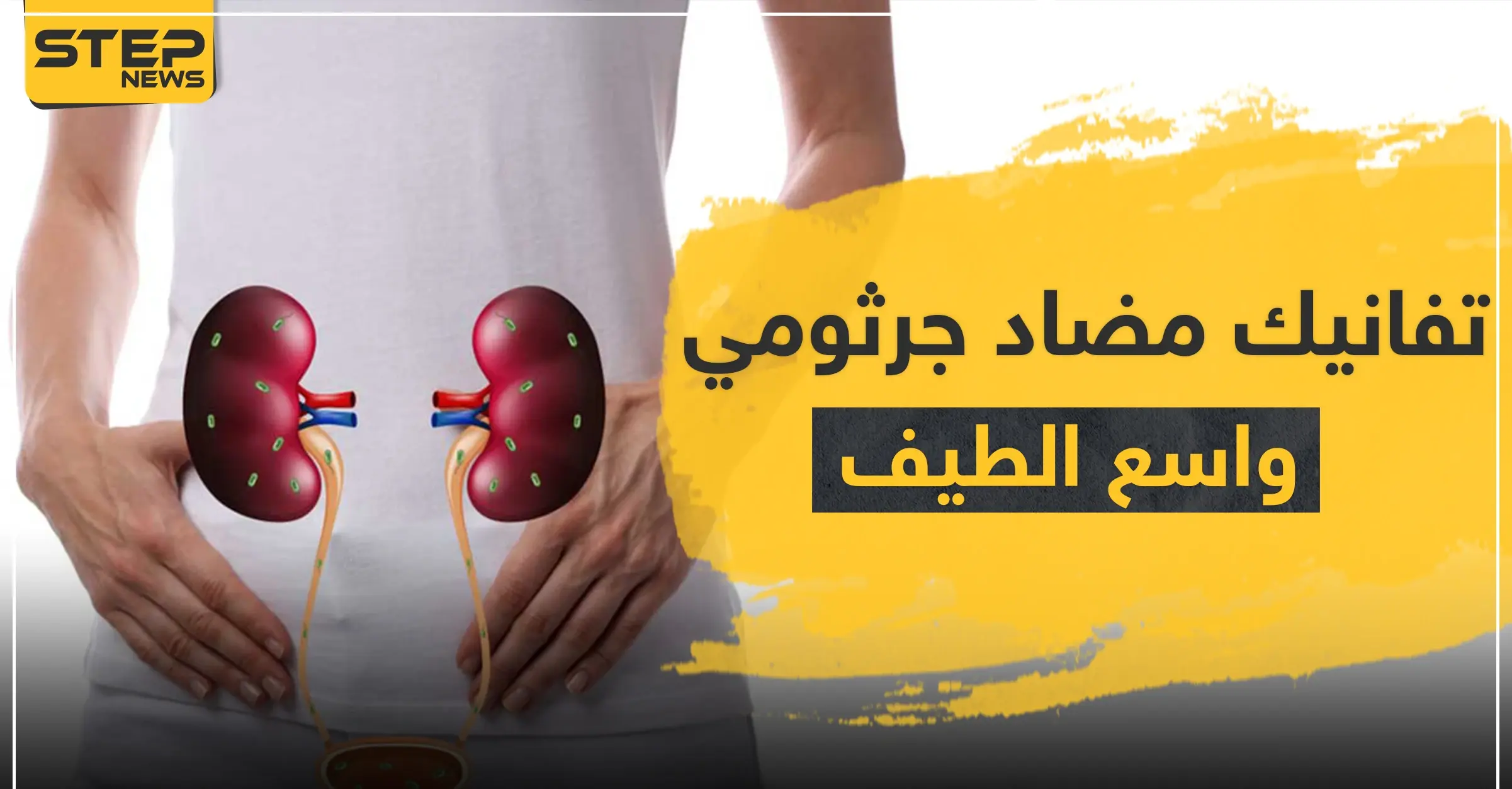 تفانيك tavanic مضاد جرثومي واسع الطيف: الغثيان