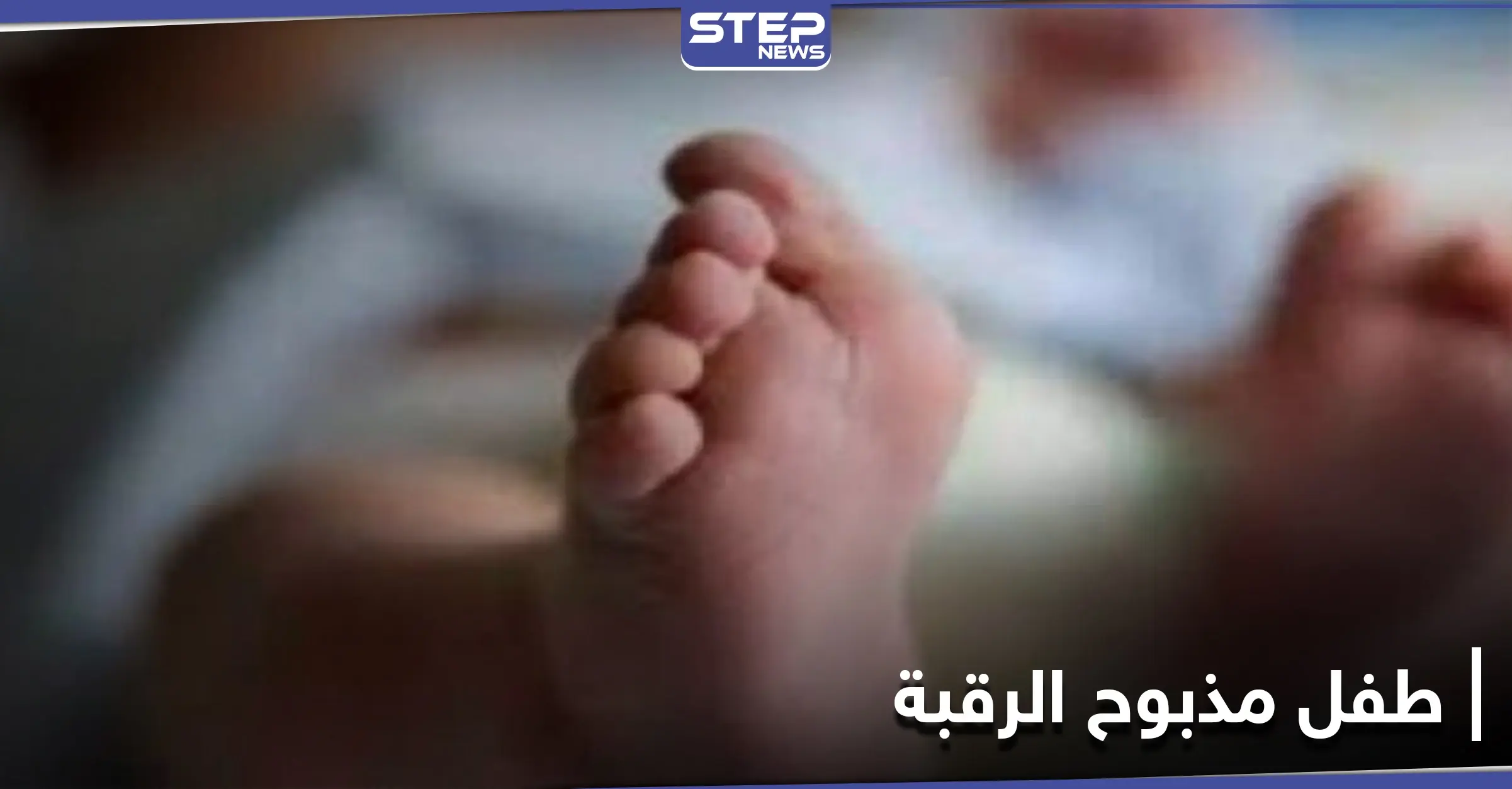 في حالة طبية نادرة .. ولادة طفل مذبوح الرقبة في مصر: الأٌقصر