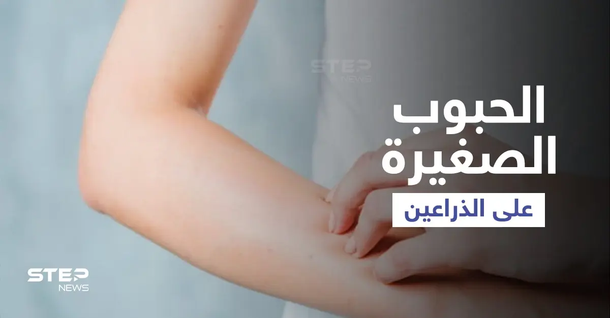 أسباب ظهور حبوب صغيرة على الذراعين وطرق علاجها إليك أهم المعلومات: التقرن الشعري