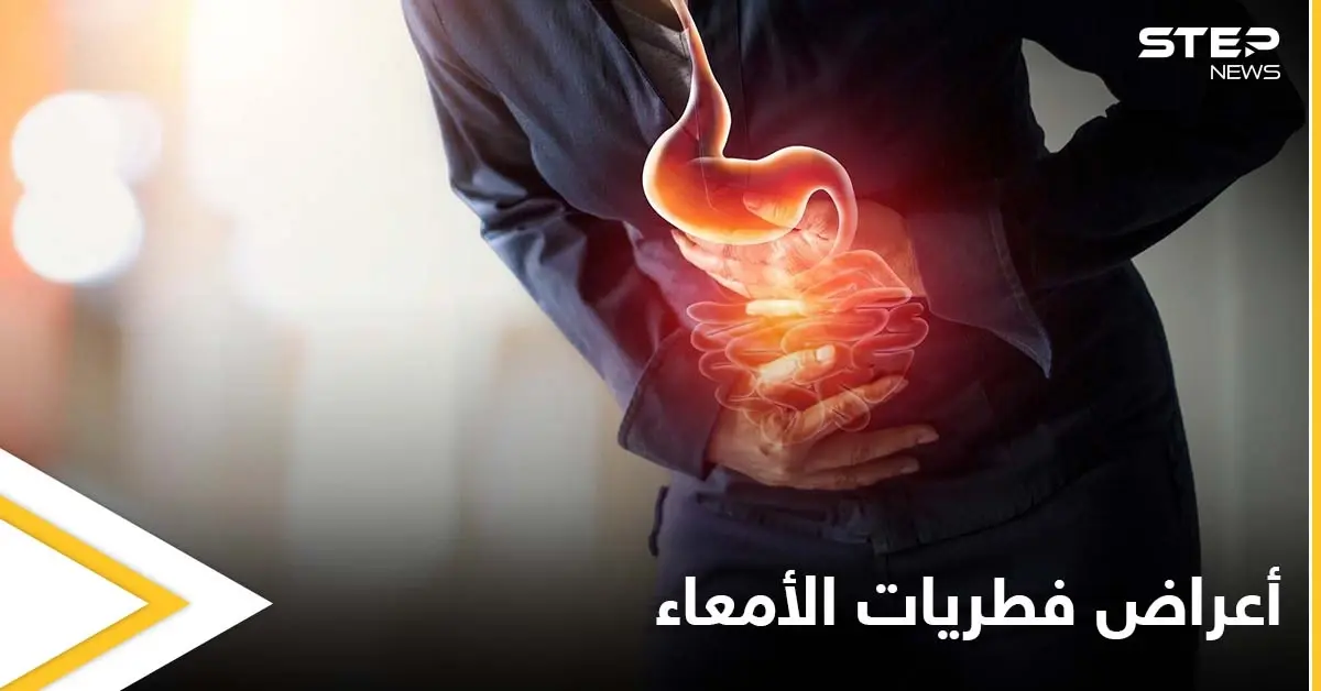 ما هي أعراض فطريات الأمعاء وخطورتها وأسباب الإصابة بها تعرف على التفاصيل: أعراض