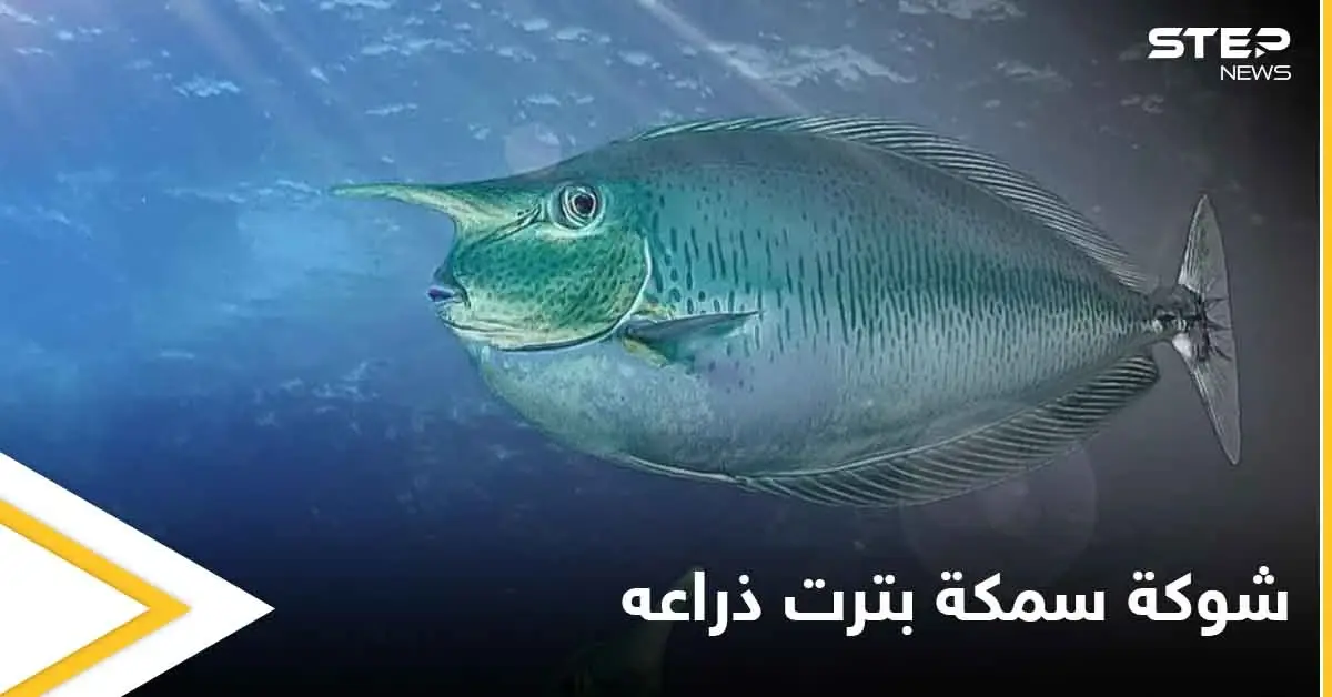 شاهد بالصور|| طاهٍ صيني يفقد ذراعه بسبب سمكة: شوكة سمكة